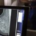 ANS amplia a cobertura da mamografia digital pelos planos de saúde. A partir de 1º de outubro, exame será obrigatório para todas as pessoas com indicação médica