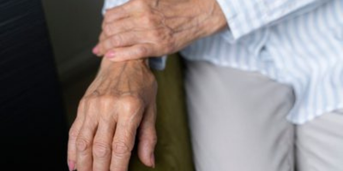 Osteoporose é uma doença silenciosa que enfraquece os ossos. Saiba quais são os fatores de risco, os sinais de alerta e as formas de prevenção e tratamento.