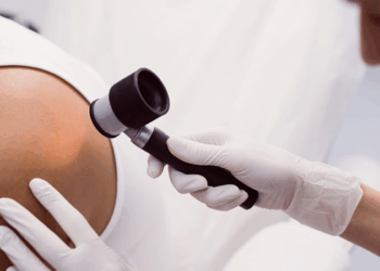 Proposta prevê distribuição gratuita de protetor solar, roupas com proteção UV, atendimento especializado e medidas de inclusão social para pacientes.