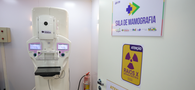 SUS amplia o acesso à mamografia, ao diagnóstico e ao tratamento do câncer de mama. Veja quem pode fazer o exame gratuitamente e como buscar atendimento.